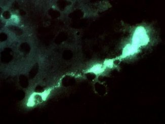 chlamydia-bacteria